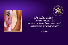 Lábszárfekély – 7 éven keresztül akkumulátor összeszerelő műhelyben dolgozott